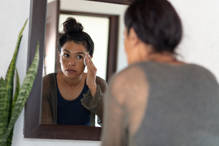 Pessoas com melasma devem aplicar filtros solares potentes, com proteção UVA e UVB. Foto: Getty Images.